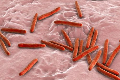 Journée mondiale de la tuberculose : tout comprendre sur la maladie en Nouvelle-Calédonie