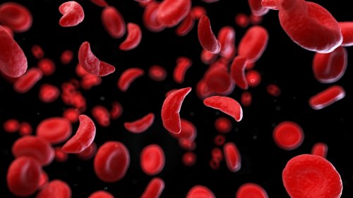 CRISPR cure for sickle cell nearly 100% effective after three years