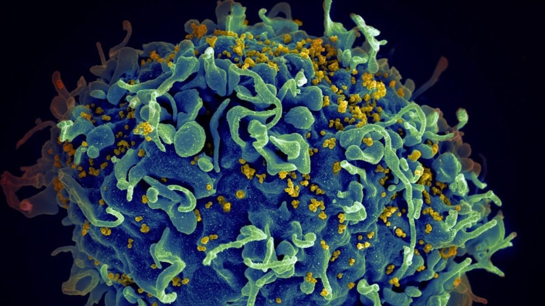 At long last, we might have an HIV vaccine