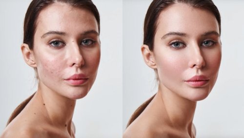 This Automatic Skin Retouching Software Could Be a Game-Changer Thanks to AI