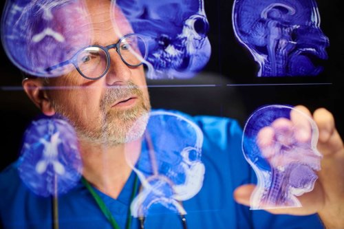 Ce fruit courant freine le vieillissement de votre cerveau, selon une étude