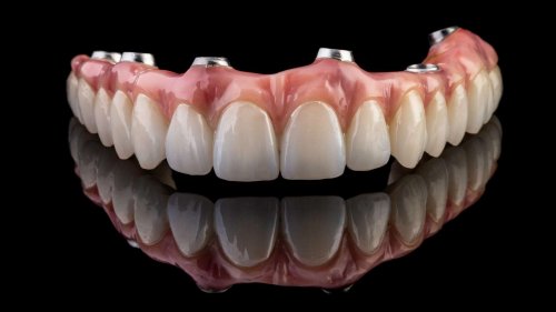Le sourire d'or d'une aristocrate du XVIIe siècle permet de comprendre les soins dentaires à cette époque