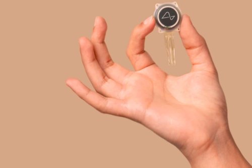 Neuralink : l’implant cérébral de Musk fait face à un sérieux problème technique