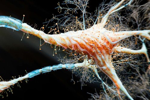 Alzheimer : le traitement novateur qui fait resurgir les souvenirs perdus