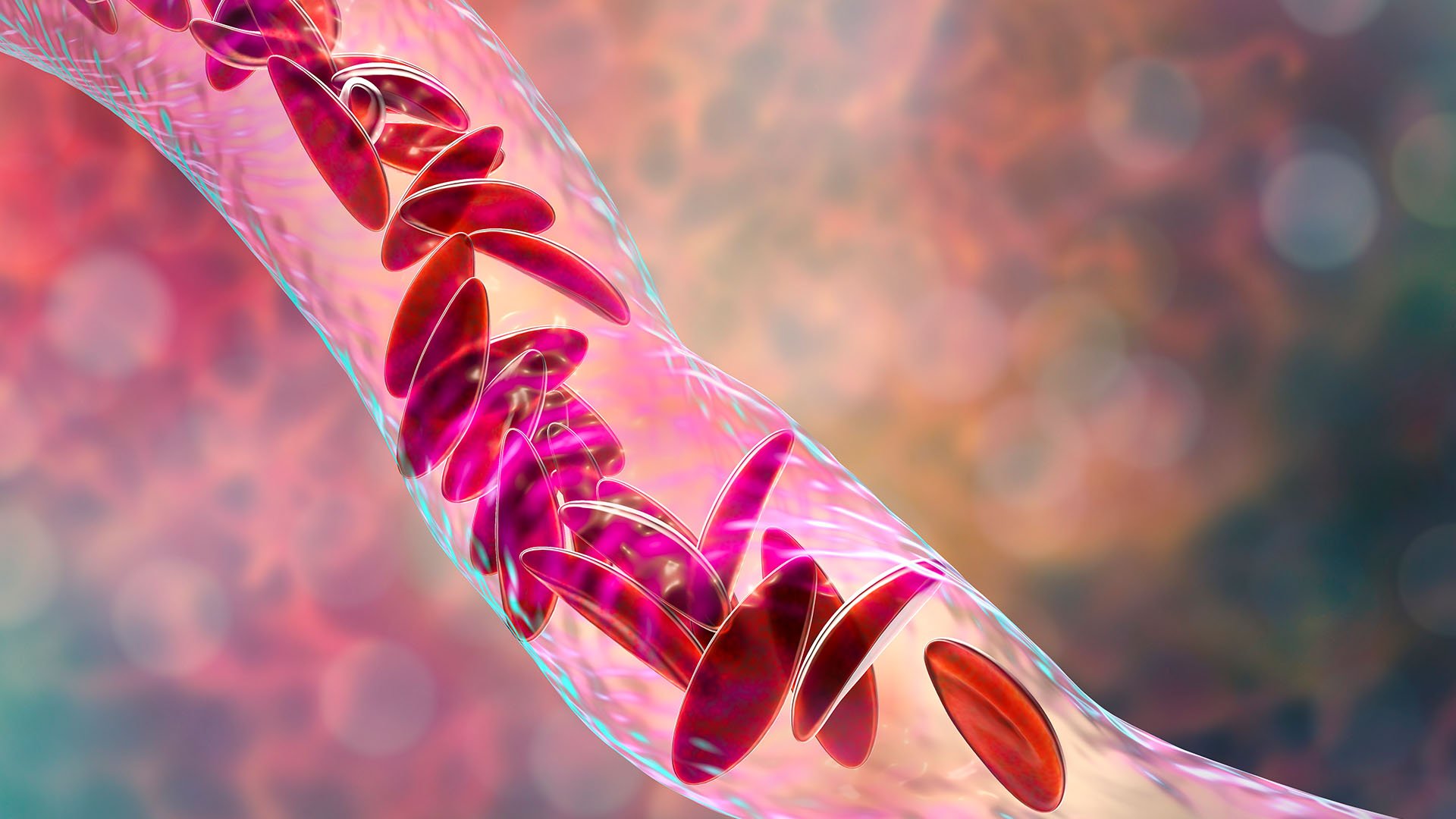 The world's 1st CRISPR therapy has been approved. Here's everything you need to know