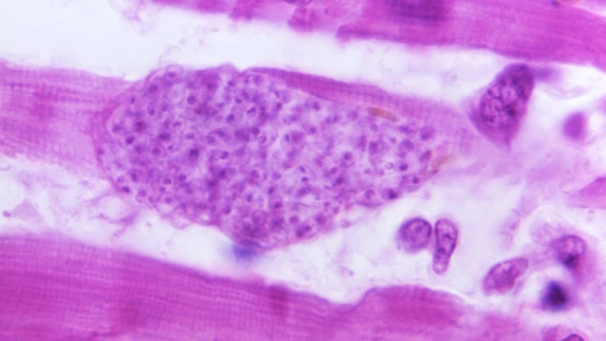 Heart-warming? More like heart-harming. Here are 5 cardiac parasites ... for Valentine's Day
