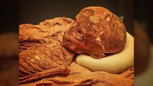Rare Insights on Ancient Egyptian Medical and Health Issues