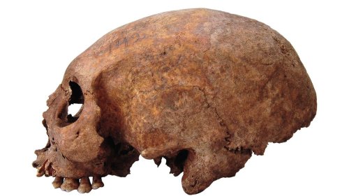 Viking Age women with cone-shaped skulls likely learned head-binding practice from far-flung region