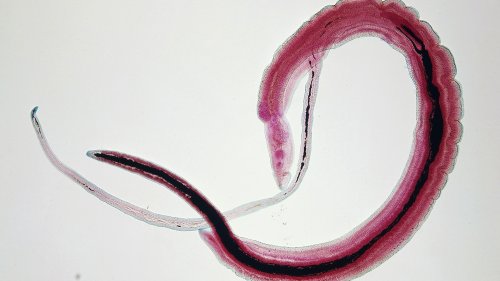 Health: Parasitic worm raises risk of cervical cancer, study finds