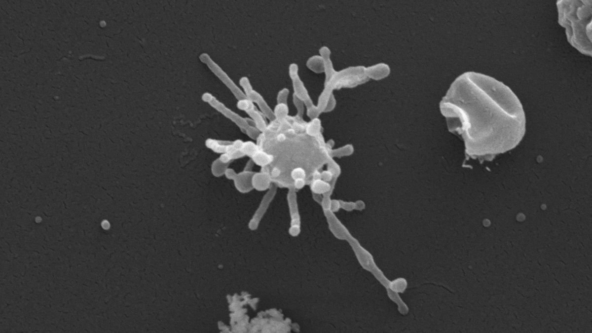 Massive tentacled microbe may be direct ancestor of all complex life
