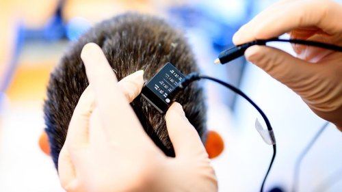 Mind-reading brain implant converts thoughts to speech almost instantly: 'breakthrough'