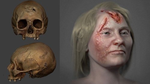 See how syphilis ravaged a woman’s face 500 years ago, in an artistic interpretation