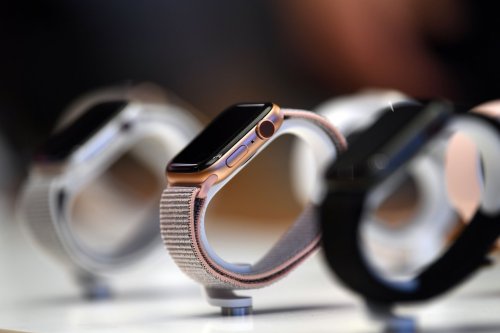 Apple Watch: Wer diese Armbänder trägt, sollte sie sofort abnehmen
