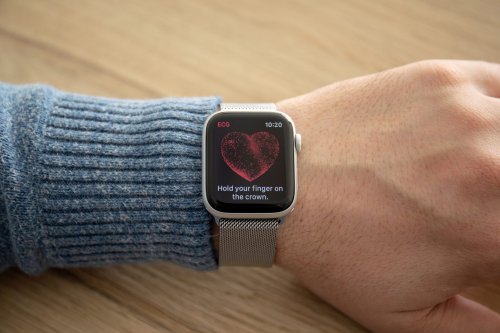 Apple Watch: Diese Funktion macht einen "lebensverändernden Unterschied"