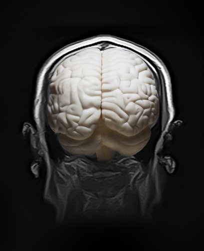 DARPA's New Brain Device Increases Learning Speed by 40%