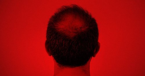 doctors-say-a-random-cheap-pill-may-actually-reverse-balding-flipboard