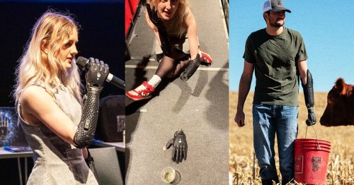 New Bionic Hand Can Detach From User, Crawl Around and Do Missions on Its Own