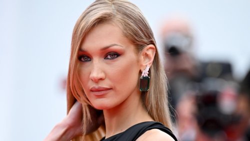 Hatte das Model mit nur 28 Jahren bereits ein Facelift? 