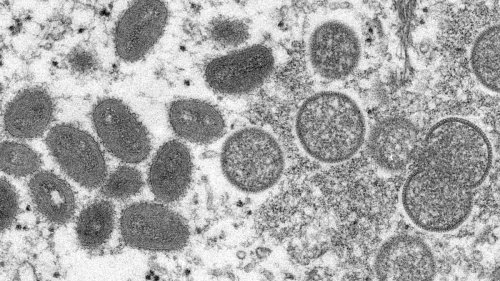 CDC issues monkeypox warning advising travelers to 'practice enhanced precautions'