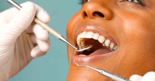 The five health warning signs that you should never ignore, according to teeth experts