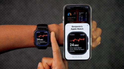 watchOS 11.4 Beta 4: Hidden Features and Improvements Found