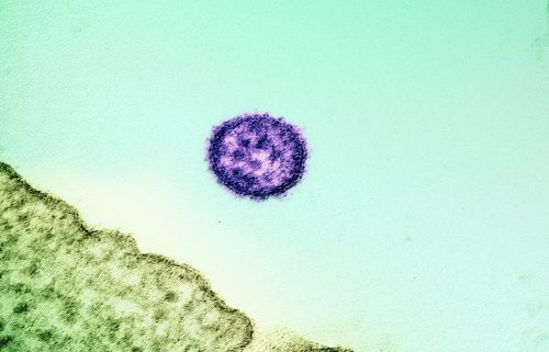 Lassa Fever Vaccine Clinical Trial Begins, Marking Key Step Forward