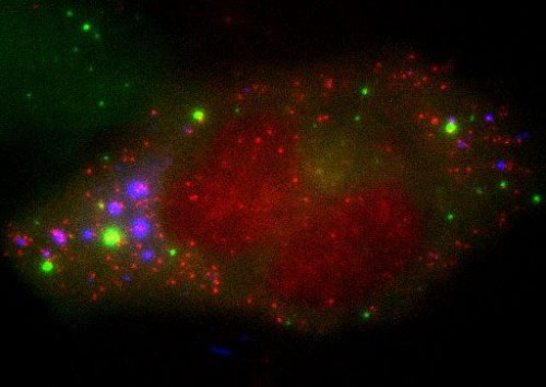 Streaming Stress: mRNA Stars in Cell Survival Saga