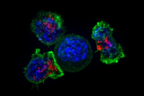 Over a Hundred Genes Found to Aid Cancer Evade the Immune System