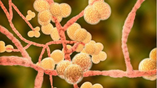 "Besorgniserregend": Immer mehr Menschen infizieren sich mit Pilz
