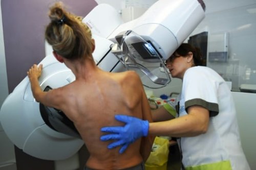 Brustkrebsvorsorge: Mammographie künftig auch für 70- bis 75-jährige Frauen