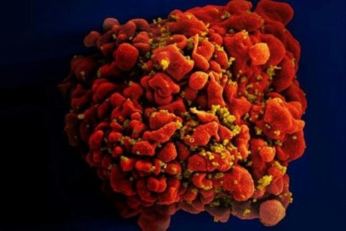 Erste Tests eines mRNA-Impfstoffes gegen Aids an Menschen