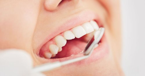 Surrey among UK places with healthiest teeth according to NHS figures
