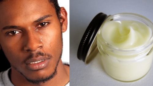 Man ends up with bleached manhood after using enlargement cream he bought online