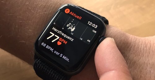 Apple Watch: Smartwatch kann Herzinfarkte erkennen – nur nicht am Handgelenk