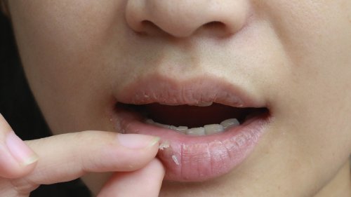 Here's What May Be Causing Your Chapped Lips - Glam