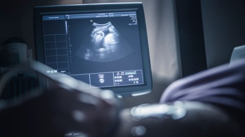 Kostenlose Down-Syndrom-Tests: Verbände warnen vor höherer Abtreibungsrate – und das halte ich als betroffene Mama davon
