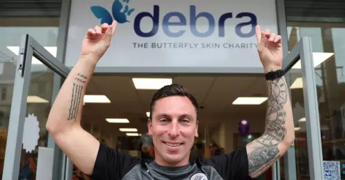 Celtic and Rangers legends Scott Brown and Graeme Souness back skin disease campaign