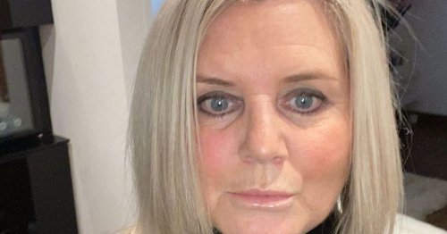 Glasgow mum who endured 'barbaric' intimate procedure without pain relief tells of horror