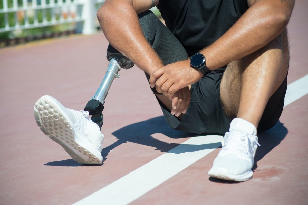 Providing Prosthetic Limbs | Limbs for Life Foundation
