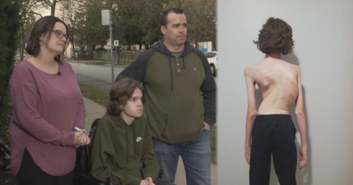 ‘It’s bad’: B.C. family’s desperate plea after teen’s surgery cancelled 4 times