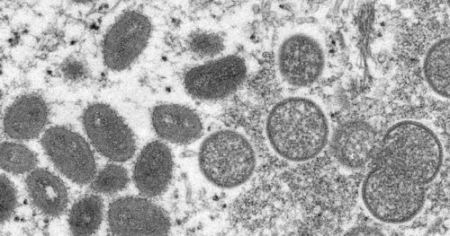 U.S. confirms monkeypox case in man who recently travelled to Canada