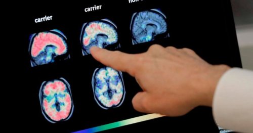 New research shows physical touch could slow onset of Alzheimer’s disease
