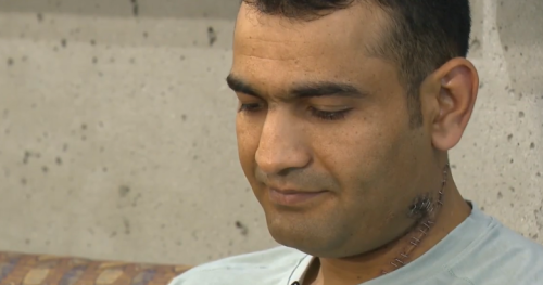 ‘All in blood’: Vancouver delivery worker describes terrifying random stabbing