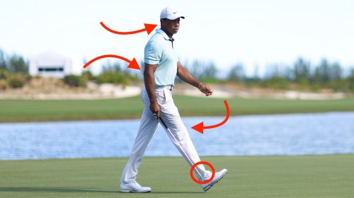 Tiger Woods says he hurts ‘everywhere.’ An expert explains what’s happening