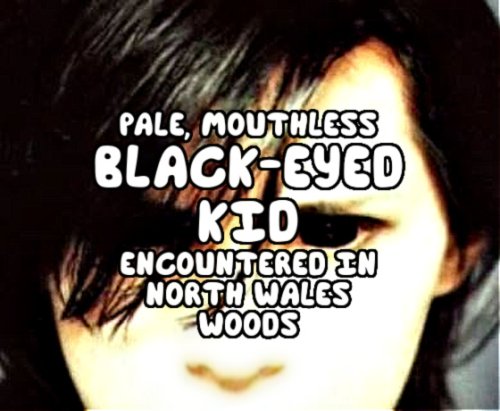 Pale, Mouthless Black-Eyed Kid Encountered in North Wales Woods