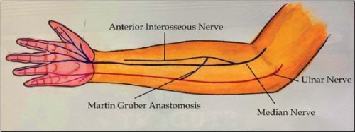Anastomosis Martin Gruber. GDL.