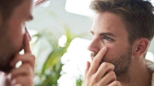 Milien entfernen: Das hilft gegen die lästigen Grieskörner