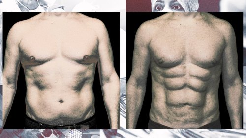 Welcome to the era of the fake six-pack