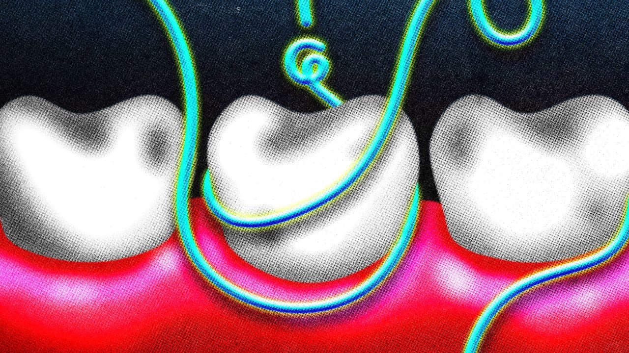 How Often Should I Floss My Teeth?