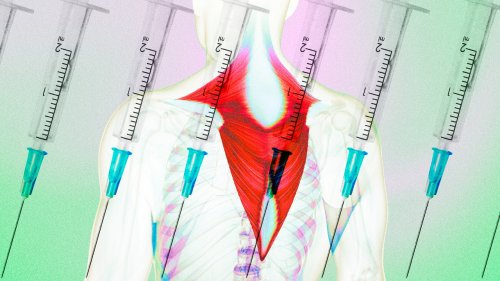 The Best Way to Help Shoulder Tension and Neck Pain May Just Be…Botox?